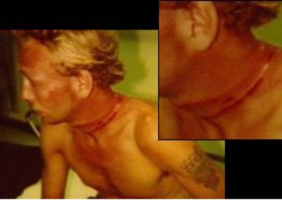 Stanley Burden with wounds around neck