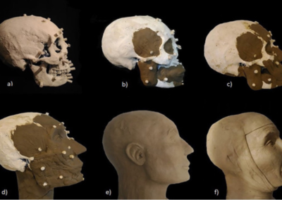 process of a facial reconstruction of Gordon Sanderson