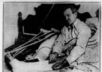 Charles Hitchcock in a cast, featured in The Waukegan Daily Sun.