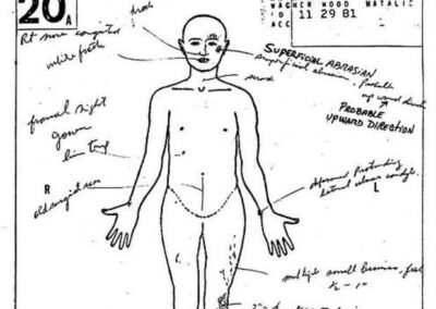 Natalie Wood’s autopsy report.