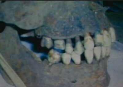 The teeth in a crime scene photo.