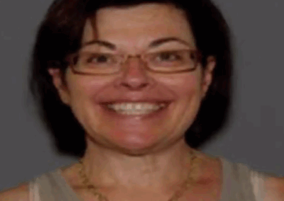 Nancy Salzman