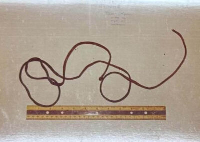 One of the ligatures found around Terry and Marty’s necks.