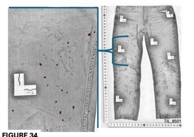 The blood spatter on Brendan’s jeans that prosecutors argued was consistent with someone moving through airborne blood.